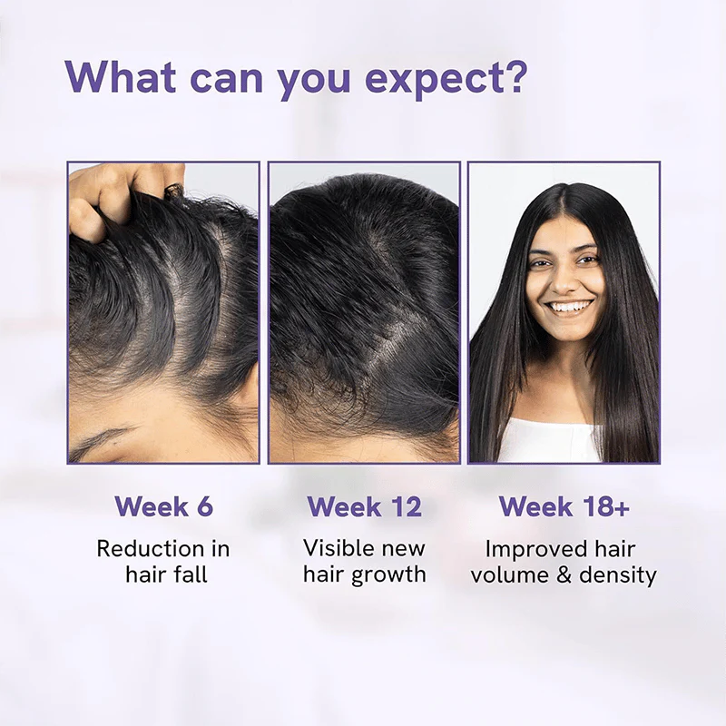 Advanced Hair Growth Roll-On Serum - Image 5