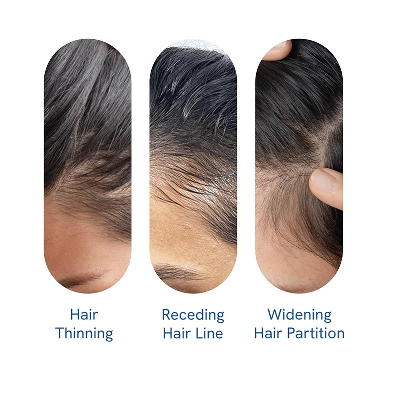 Advanced Hair Growth Roll-On Serum - Image 8