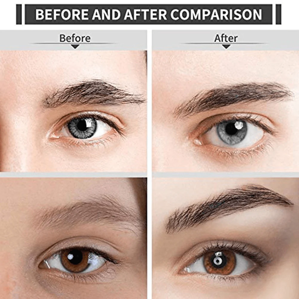 Chic Beauty Eyebrow Epilator - Image 7