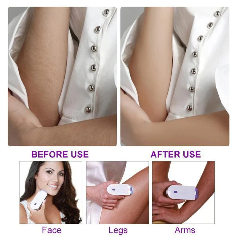 Durable and Portable Painless Epilator - Image 3