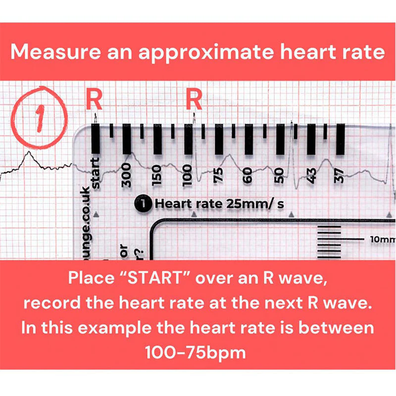ECG 7 Step Ruler - Image 3