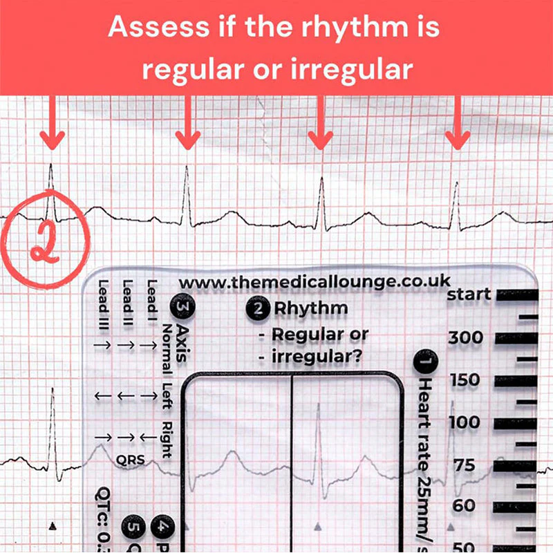ECG 7 Step Ruler - Image 4