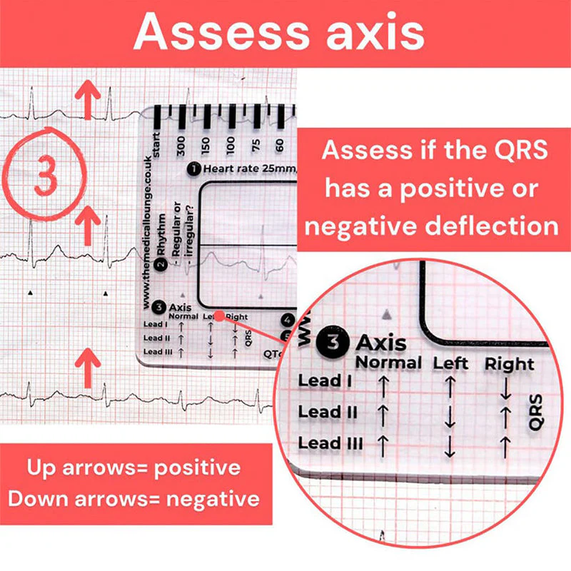 ECG 7 Step Ruler - Image 5