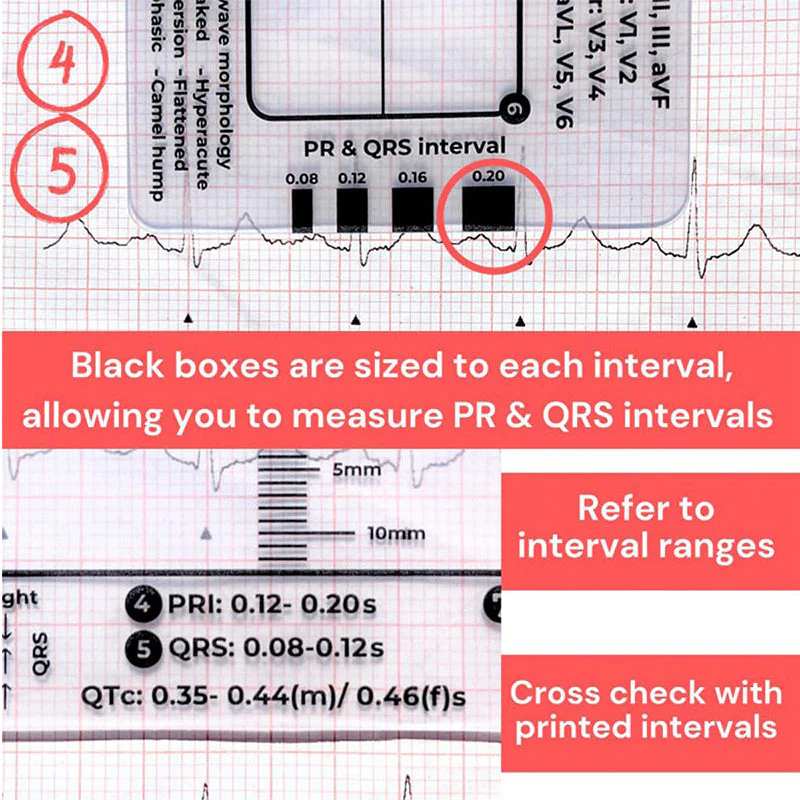 ECG 7 Step Ruler - Image 6