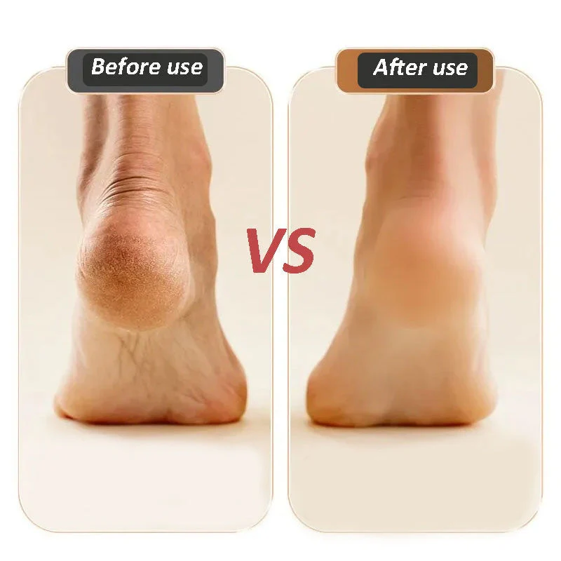 Electric Callus Foot Grinder - Image 7
