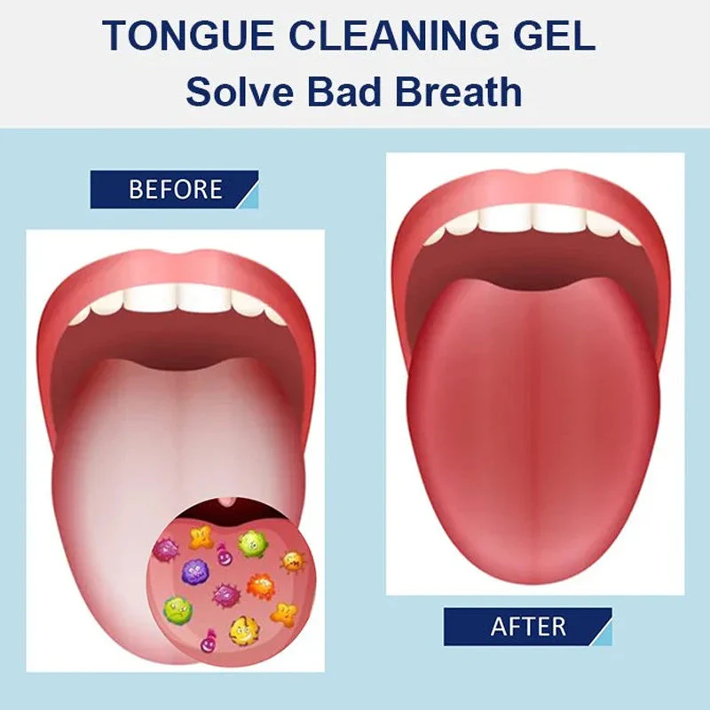 Fresh Breath Tongue Cleaning Gel Set - Image 2