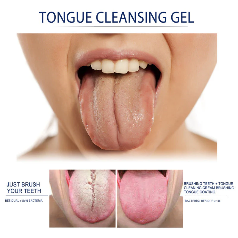 Fresh Breath Tongue Cleaning Gel Set - Image 7