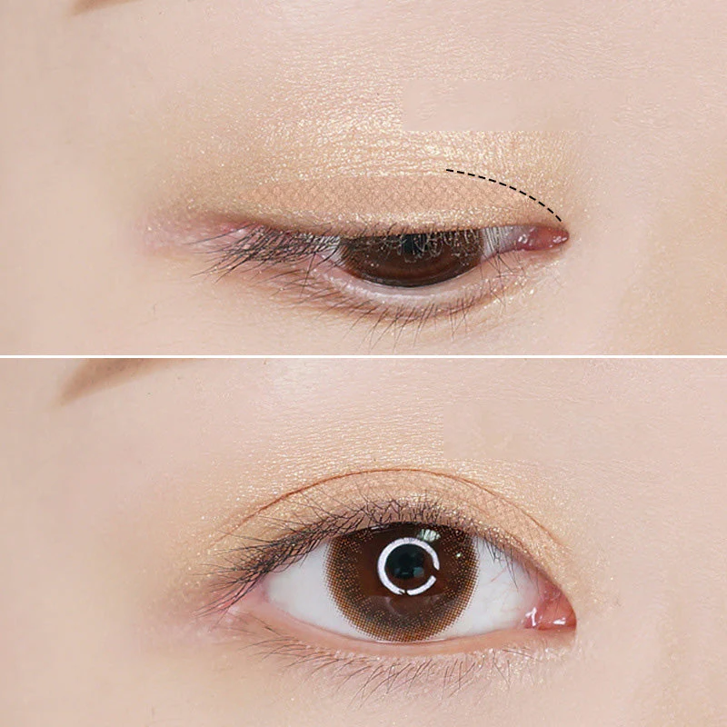 Glue-Free Invisible Double Eyelid Sticker - Image 10