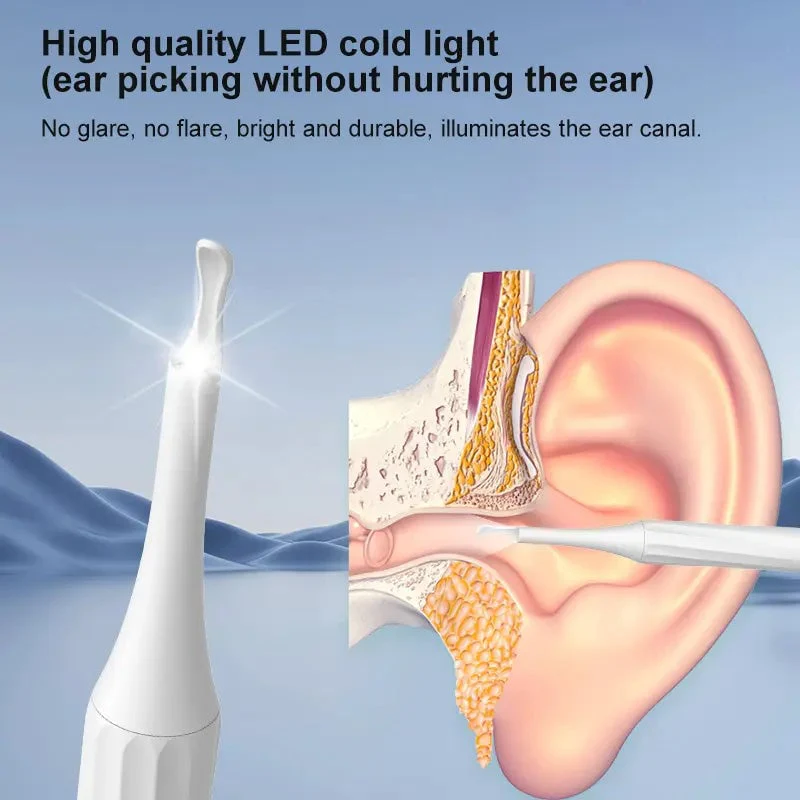 HD Camera Ear Wax Removal Kit - Image 7