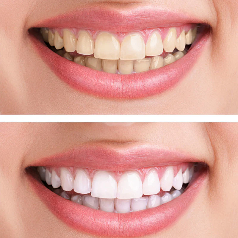 Hydroxyapatite Toothpaste - Image 2