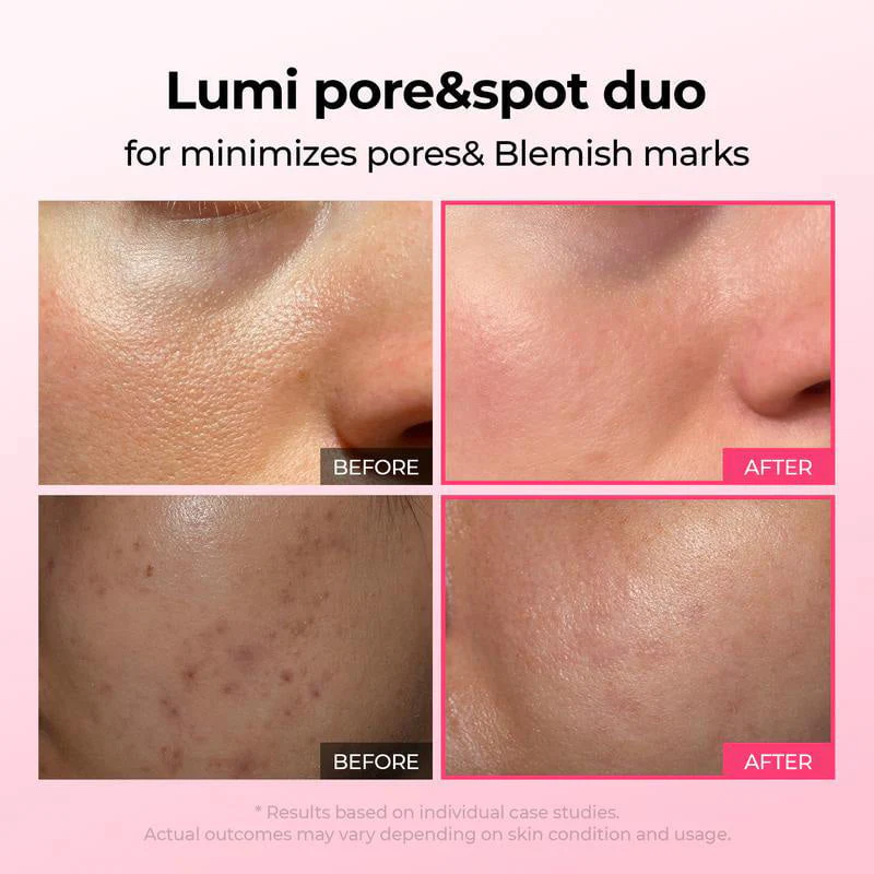 Intensive Discoloration Serum - Image 10