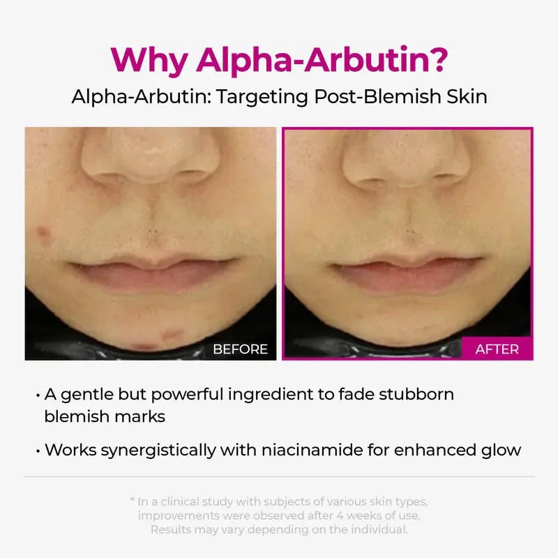 Intensive Discoloration Serum - Image 11