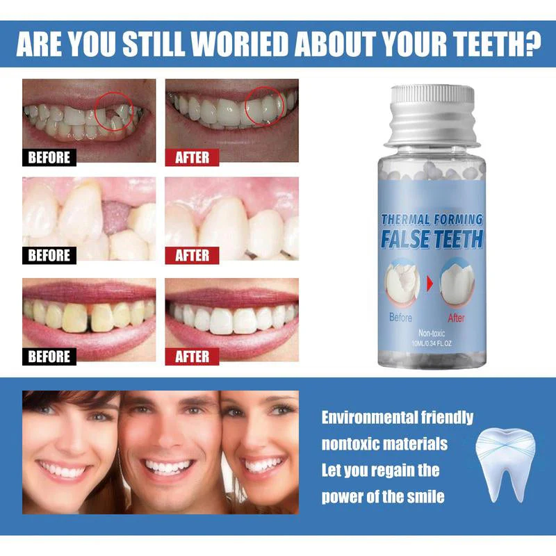 Moldable False Teeth for Temporary Tooth Fillings - Image 8