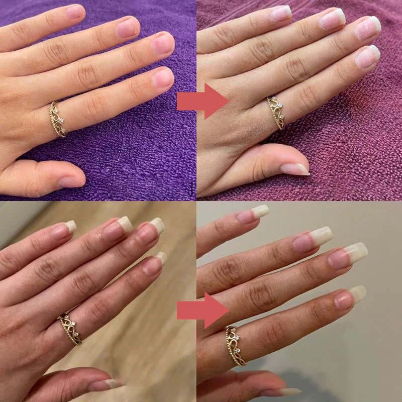 Nails Nutritious Growth Oil - Image 8