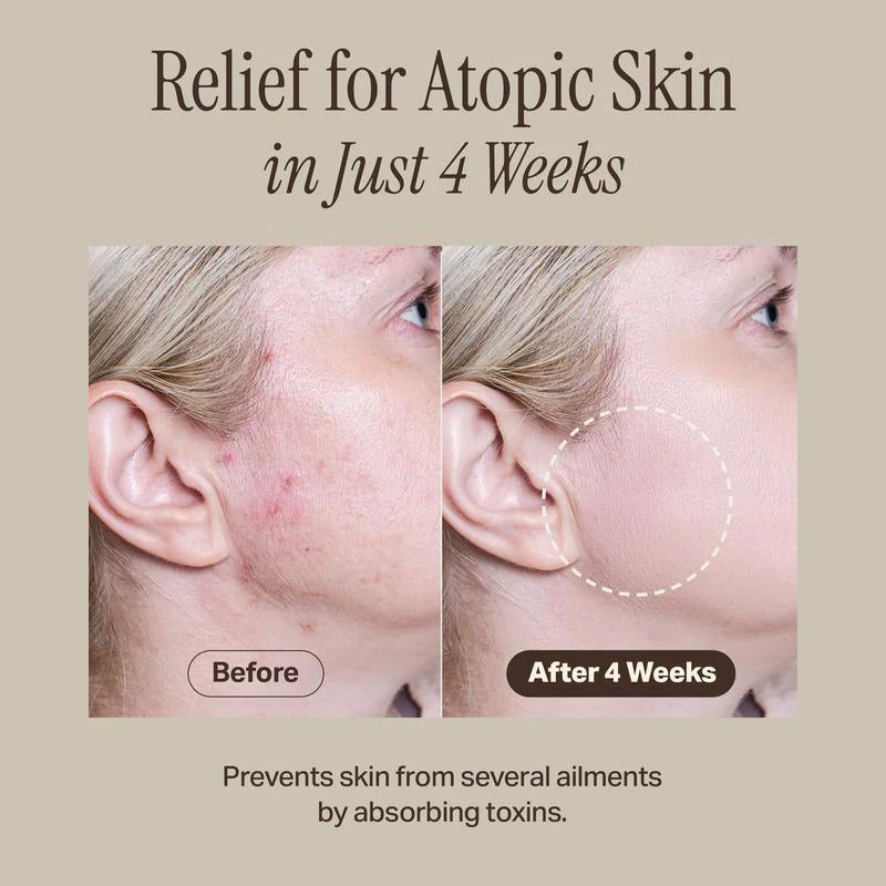 Relief Mud Mask - Image 8