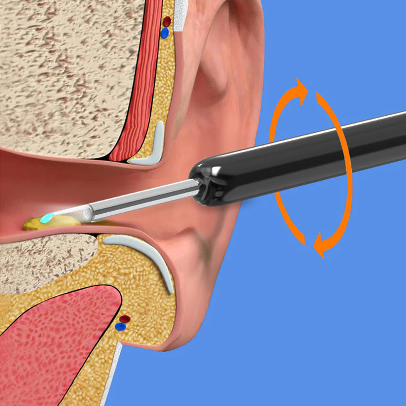 Smart Visible Earpick - Image 9