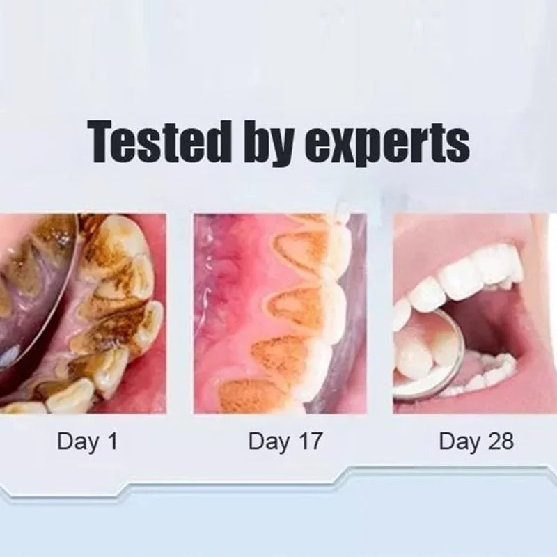 Super Probiotic-6 Toothpaste - Image 4