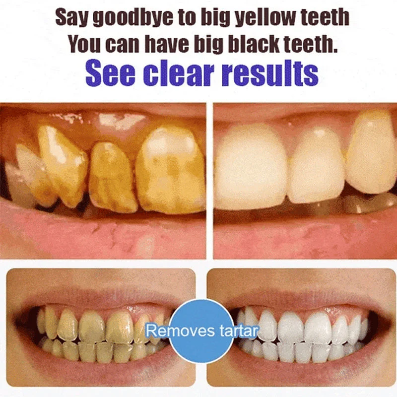 Super Probiotic-6 Toothpaste - Image 6