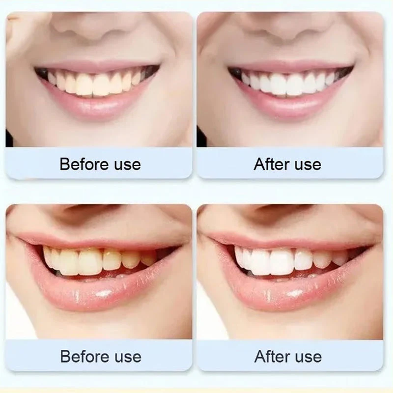 Super Probiotic-6 Toothpaste - Image 7