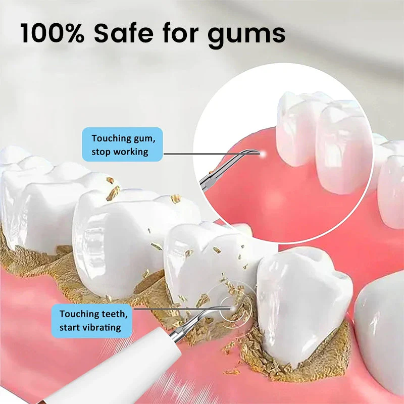 Teeth Flosser - Image 4