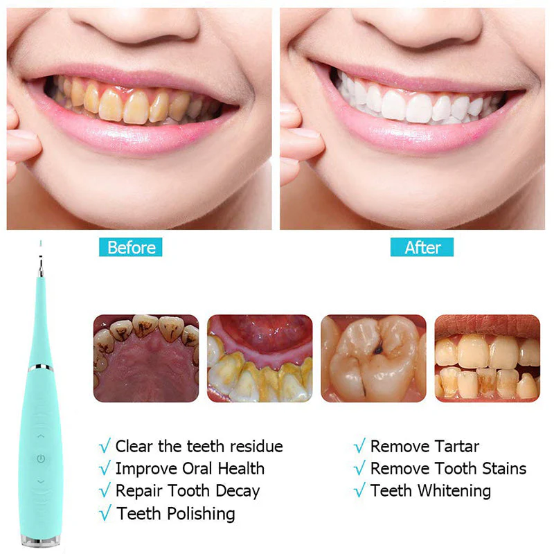 Teeth Flosser - Image 8
