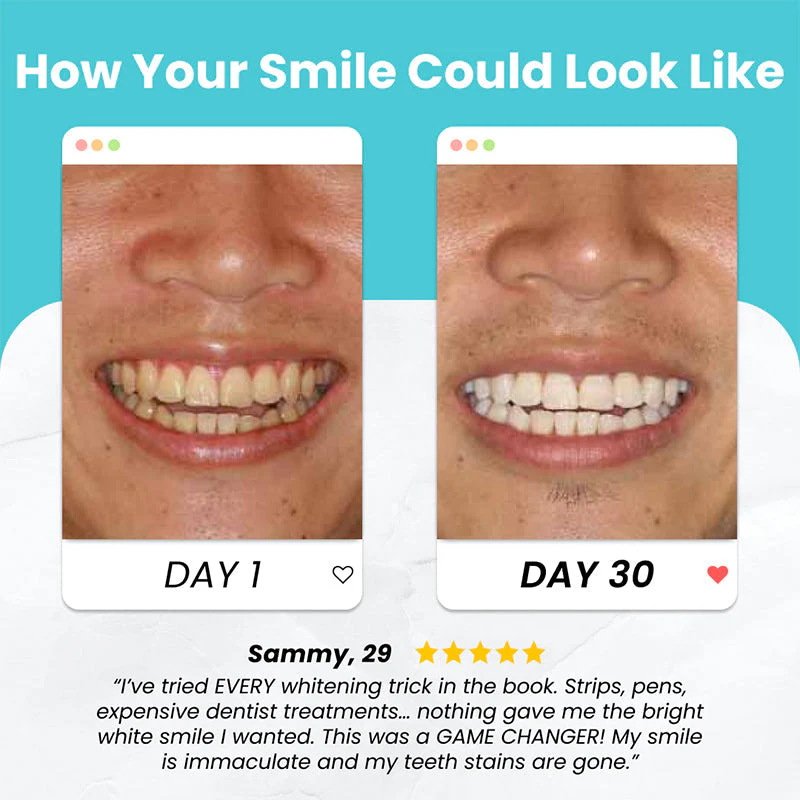 U Shaped Electric Toothbrush - Image 15